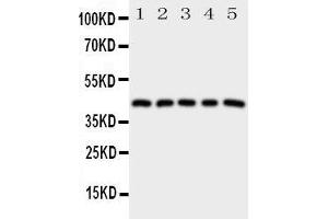 Western Blotting (WB) image for anti-Prostaglandin E Receptor 1 (Subtype EP1), 42kDa (PTGER1) (AA 387-404), (C-Term) antibody (ABIN3043155) (PTGER1 anticorps  (C-Term))