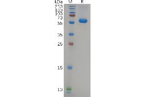 SARS-CoV-2 (2019-nCoV) S protein RBD(L452R & T487K), hFc Tag on SDS-PAGE under reducing condition.