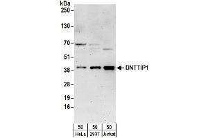 anti-Deoxynucleotidyltransferase, Terminal, Interacting Protein 1 (DNTTIP1) (AA 279-329) antibody