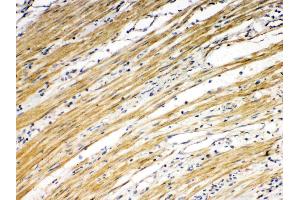 DR5 was detected in paraffin-embedded sections of human intetsinal cancer tissues using rabbit anti- DR5 Antigen Affinity purified polyclonal antibody (Catalog # ) at 1 µg/mL.