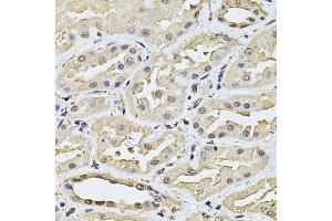Immunohistochemistry of paraffin-embedded human kidney using SP110 Antibody (ABIN6290941) at dilution of 1:100 (40x lens). (SP110 anticorps)