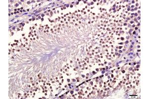 Paraformaldehyde-fixed, paraffin embedded mouse testis, Antigen retrieval by boiling in sodium citrate buffer (pH6.