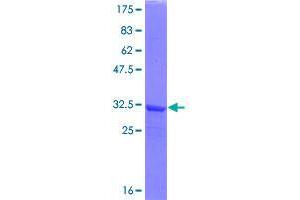Image no. 1 for Selenophosphate Synthetase 2 (SEPHS2) (AA 1-59) protein (GST tag) (ABIN1319524)