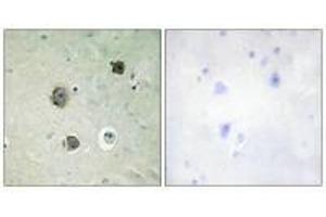 Immunohistochemistry analysis of paraffin-embedded human brain tissue using CDK5 (Ab-15) antibody.