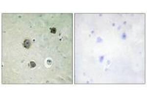 Immunohistochemistry analysis of paraffin-embedded human brain tissue using CDK5 (Ab-15) antibody. (CDK5 anticorps  (Tyr15))