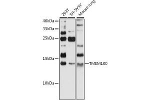 Western blot analysis of extracts of various cell lines, using TMEM100 antibody (ABIN7270950) at 1:1000 dilution.