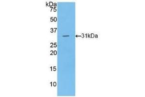 Detection of Recombinant LIPG, Human using Polyclonal Antibody to Lipase, Endothelial (LIPG)