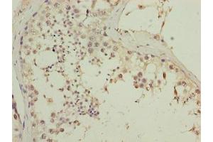 Immunohistochemistry of paraffin-embedded human testis tissue using ABIN7147501 at dilution of 1:100 (CGGBP1 anticorps  (AA 1-167))