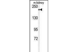 Western blot analysis of anti-CHAK1 Antibody (C-term) (ABIN392614 and ABIN2837991) in mouse kidney tissue lysates (35 μg/lane). (TRPM7 anticorps  (C-Term))