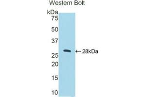 Western blot analysis of the recombinant protein. (CTSC anticorps  (AA 231-462))