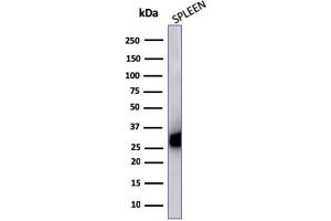 Western Blot Analysis of Human Spleen cell lysate using HLA-Pan Mouse Monoclonal Antibody (CR3/43). (MHC Class II HLA-DP/DQ/DR anticorps)
