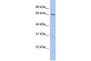WB Suggested Anti-DQX1 Antibody Titration:  0. (DQX1 anticorps  (N-Term))