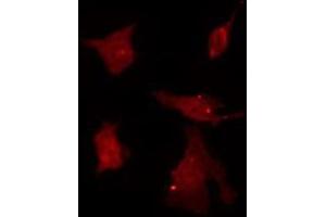 ABIN6266919 staining HeLa by IF/ICC.