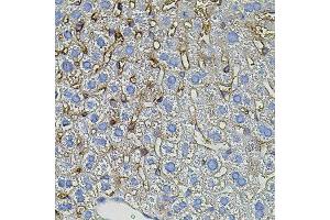 Immunohistochemistry of paraffin-embedded mouse liver using TGFA antibody. (Pro-TGF-alpha anticorps)