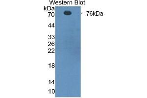 Western blot analysis of recombinant Rat CTTN. (Cortactin anticorps  (AA 1-509))