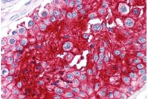 Human Testis (formalin-fixed, paraffin-embedded) stained with BSG antibody ABIN239812 at 10 ug/ml followed by biotinylated anti-mouse IgG secondary antibody ABIN481714, alkaline phosphatase-streptavidin and chromogen. (CD147 anticorps)