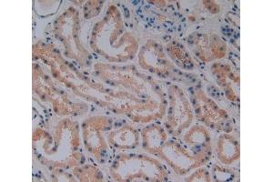 Detection of DBP in Human Kidney Tissue using Polyclonal Antibody to Vitamin D Binding Protein (DBP)