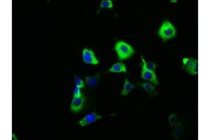 Immunofluorescence staining of MCF-7 cells with ABIN7171161 at 1:166, counter-stained with DAPI. (SYT6 anticorps  (AA 104-425))