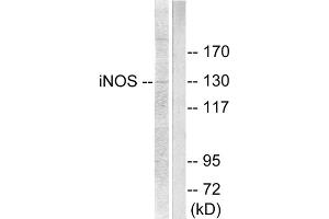 Western blot analysis of extracts from NIH/3T3 cells, using NOS2 antibody (ABIN5976446). (NOS2 anticorps  (C-Term))