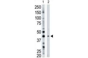 Western Blotting (WB) image for anti-ADP-Ribosyltransferase 3 (ART3) antibody (ABIN3001504) (ART3 anticorps)