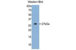 Western Blotting (WB) image for anti-FK506 Binding Protein 3, 25kDa (FKBP3) (AA 2-224) antibody (ABIN1078042) (FKBP3 anticorps  (AA 2-224))