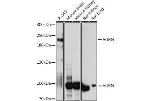 Western blot analysis of extracts of various cell lines, using AGRN antibody (ABIN7265516) at 1:1000 dilution. (AGRN anticorps  (AA 30-350))