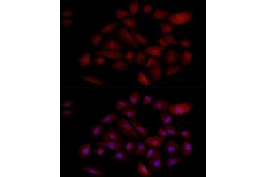 Immunofluorescence analysis of A-549 cells using PGP9.
