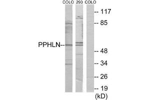 Western Blotting (WB) image for anti-Periphilin 1 (PPHLN1) (Internal Region) antibody (ABIN1849790) (PPHLN1 anticorps  (Internal Region))