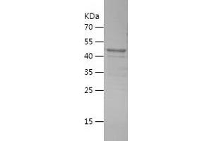Western Blotting (WB) image for Collectin Sub-Family Member 11 (COLEC11) (AA 47-271) protein (His-IF2DI Tag) (ABIN7122452)