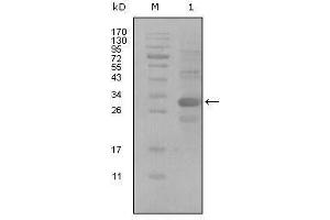 Western Blot showing ALCAM antibody used against truncated Trx-ALCAM recombinant protein (1). (CD166 anticorps  (AA 405-524))