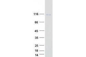 Validation with Western Blot