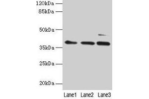 Western blot All lanes: MRPL3 antibody at 6 μg/mL Lane 1: Hela whole cell lysate Lane 2: HepG2 whole cell lysate Lane 3: A549 whole cell lysate Secondary Goat polyclonal to rabbit IgG at 1/10000 dilution Predicted band size: 39 kDa Observed band size: 39 kDa (MRPL3 anticorps  (AA 201-348))