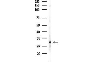 anti-Fragile X Mental Retardation 1 Neighbor (FMR1NB) (C-Term) antibody