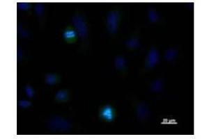 Immunostaining analysis in HeLa cells.