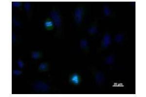 Immunostaining analysis in HeLa cells. (NDC80 anticorps)