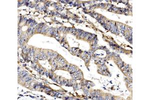 IHC analysis of MC4R using anti-MC4R antibody (ABIN7602763).