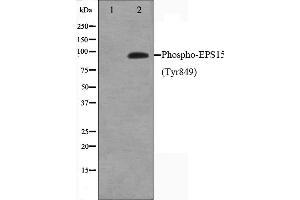 Western blot analysis on HepG2 cell lysate using Phospho-EPS15(Tyr849) Antibody,The lane on the left is treated with the antigen-specific peptide.
