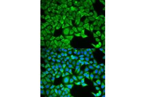 Immunofluorescence analysis of HeLa cells using SLC3A1 antibody.