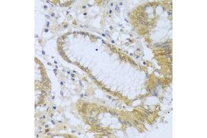 Immunohistochemistry of paraffin-embedded human stomach using  antibody (ABIN6127321, ABIN6136446, ABIN6136448 and ABIN6216005) at dilution of 1:100 (40x lens). (ACP1 anticorps  (AA 1-158))