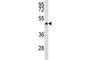 SIRT3 antibody western blot analysis in MDA-MB453 lysate. (SIRT3 anticorps  (AA 56-84))