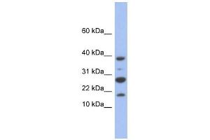 NDUFC1 antibody used at 1 ug/ml to detect target protein.