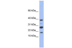 NDUFC1 antibody used at 1 ug/ml to detect target protein. (NDUFC1 anticorps)