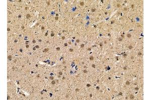 ABIN7095427 and ABIN7099484 at 1/100 staining rat brain tissue by IHC-P. (DPY30 anticorps)