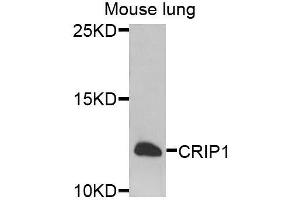 Western blot analysis of extracts of mouse lung, using CRIP1 antibody. (CRIP1 anticorps  (AA 1-77))