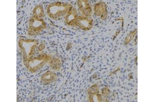 ABIN6276890 at 1/100 staining Human uterus tissue by IHC-P.