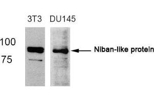 Western blot analysis of extracts from 3T3 and DU145 cells using Niban-like protein(Ab-712) antibody. (MEG3 anticorps)