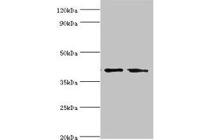 Western blot All lanes: LGALS9 antibody at 14 μg/mL Lane 1: Hela whole cell lysate Lane 2: Jurkat whole cell lysate Secondary Goat polyclonal to rabbit IgG at 1/10000 dilution Predicted band size: 40, 36, 35, 27, 26, 39 kDa Observed band size: 40 kDa (Galectin 9 anticorps  (AA 1-240))