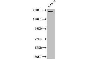 Western Blot Positive WB detected in: Jurkat whole cell lysate All lanes: DOCK7 antibody at 3 μg/mL Secondary Goat polyclonal to rabbit IgG at 1/50000 dilution Predicted band size: 243, 242, 239, 240, 73 kDa Observed band size: 243 kDa (DOCK7 anticorps  (AA 1440-1671))