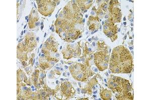 Immunohistochemistry of paraffin-embedded Human stomach using PLCG1 Polyclonal Antibody at dilution of 1:100 (40x lens).
