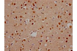 IHC image of ABIN7127644 diluted at 1:100 and staining in paraffin-embedded human brain tissue performed on a Leica BondTM system.